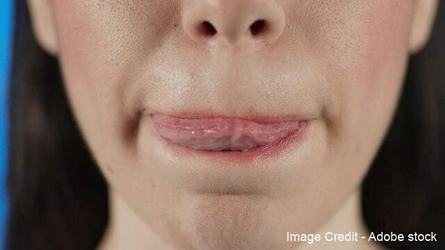 Avoid rubbing, biting, or licking lips to prevent dryness and chapping