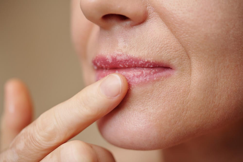 Daily lip care routine: cleanse, exfoliate, moisturize, and treat